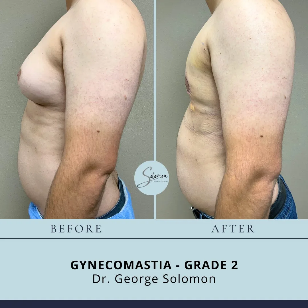 Before and Afters (4)