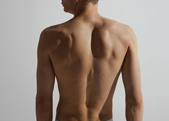 Preparation for Back Liposuction Banner