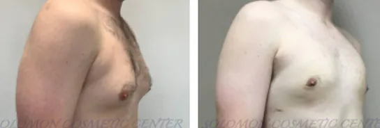 4_(1)_(1)_(1)_(1)_(1)