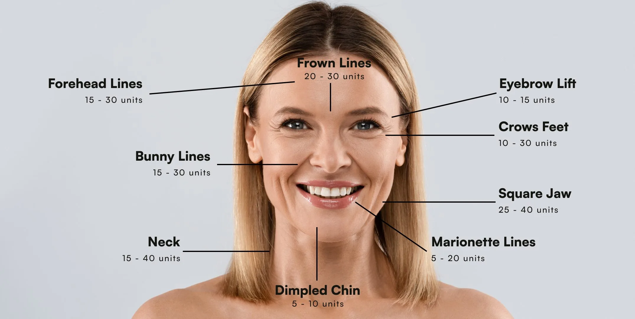 Areas of Botox injections In Tampa, Clearwater