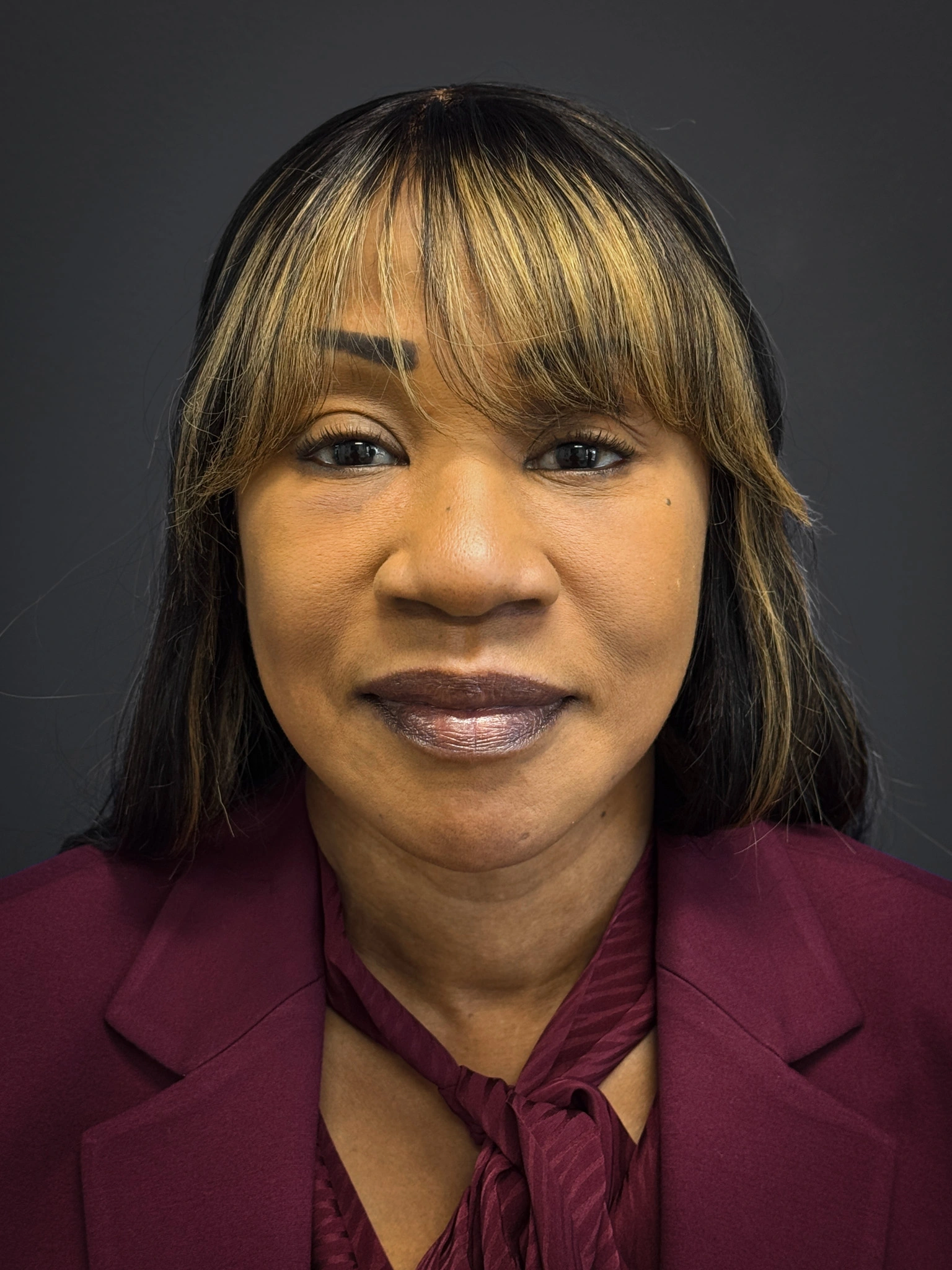 Facelift-Lower-Blepharoplasty-Case--6866 | After Eyelid Surgery 1