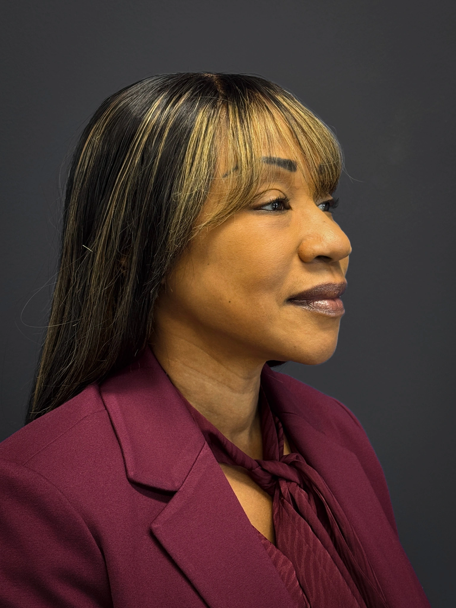 Facelift-Lower-Blepharoplasty-Case--6866 | After Eyelid Surgery 6