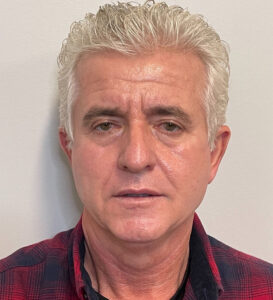 Facelift-Blepharoplasty-Case--291 | Before Dr. Samir Rao 1