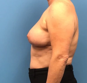 Case--314 | After Dr. Samir Rao 2