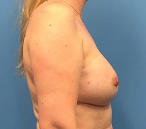 Case--138 | After Dr. Samir Rao 2