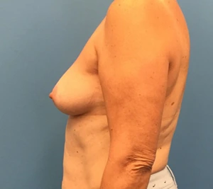 Case--133 | Before Dr. Samir Rao 2