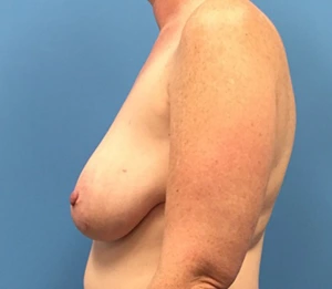 Case--137 | Before Dr. Samir Rao 2