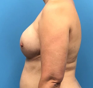 Case--136 | Before Dr. Samir Rao 2