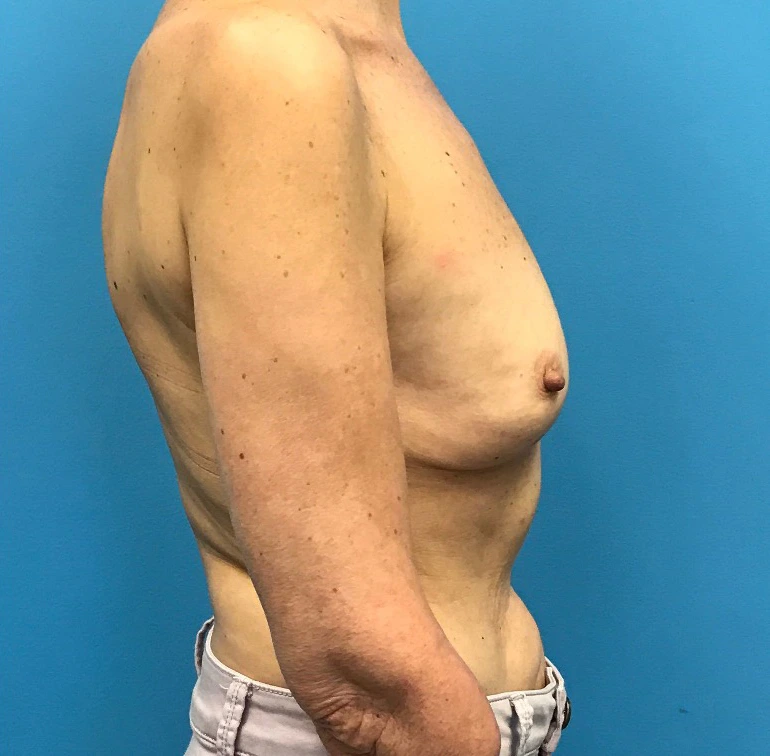 Revision-Augmentation--13287 | Before Revision Augmentation 3