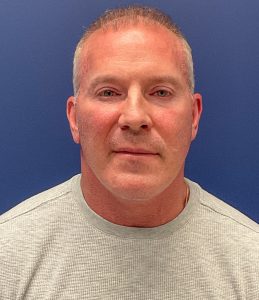 Facelift-Necklift-Blepharoplasty-Case--5535 | After Face360 1