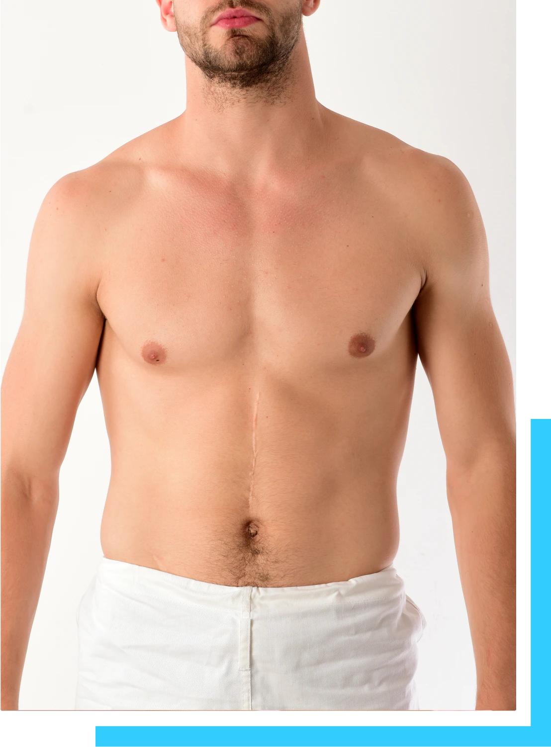 Surgical Procedure Banner