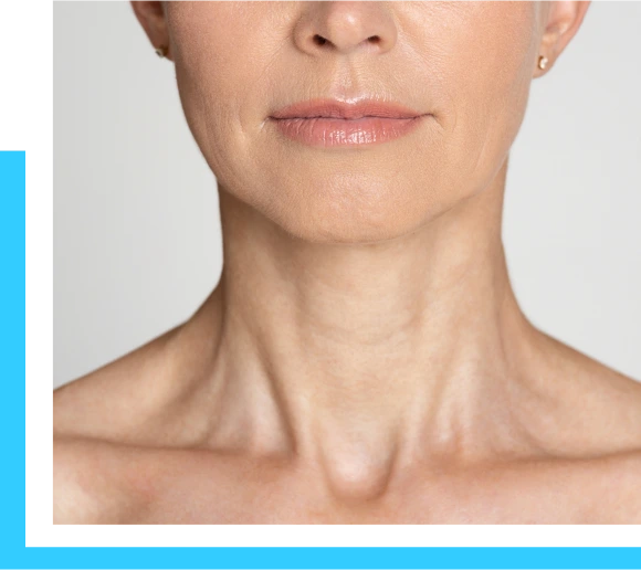 What Is a Neck Lift? Banner
