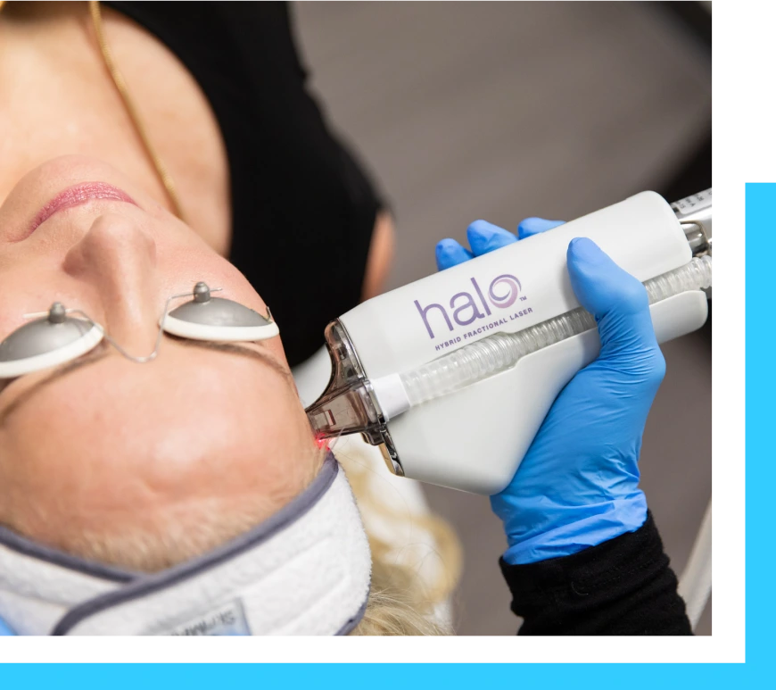Englewood Cliffs NJ Skin Laser Treatment: Halo Laser Banner