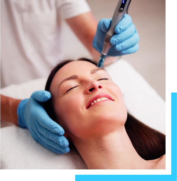 What is Microneedling? Banner