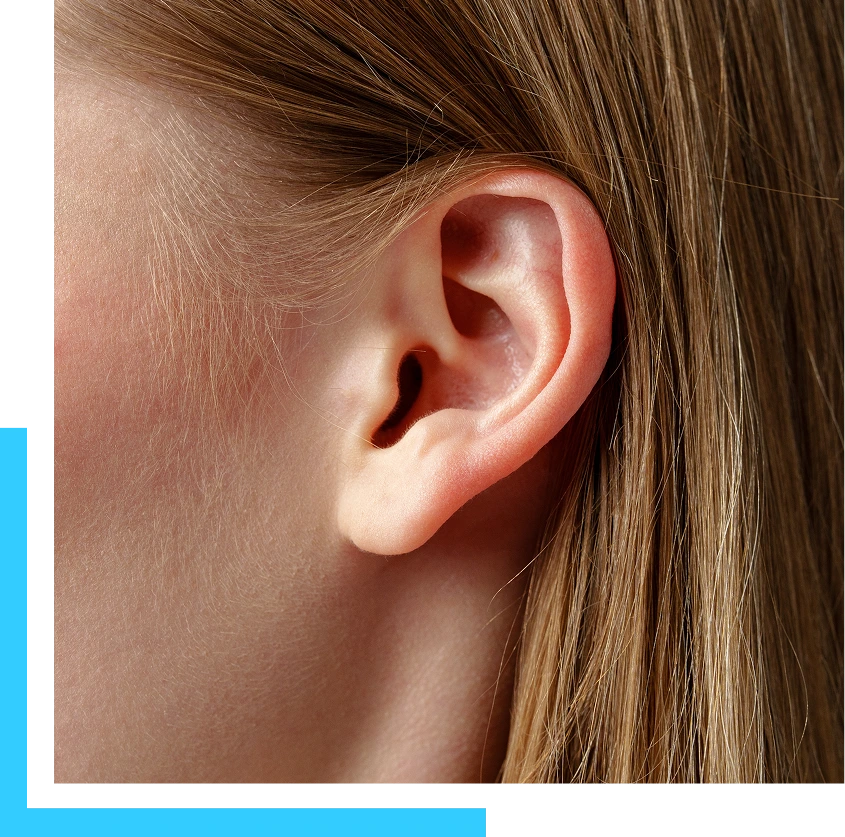 Candidates for Otoplasty Banner