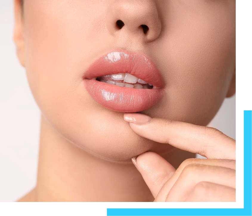 What Are Lip Fillers? Banner
