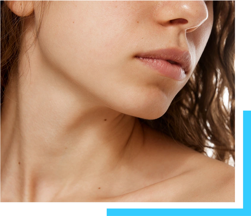 Candidates for Jawline Fillers Banner