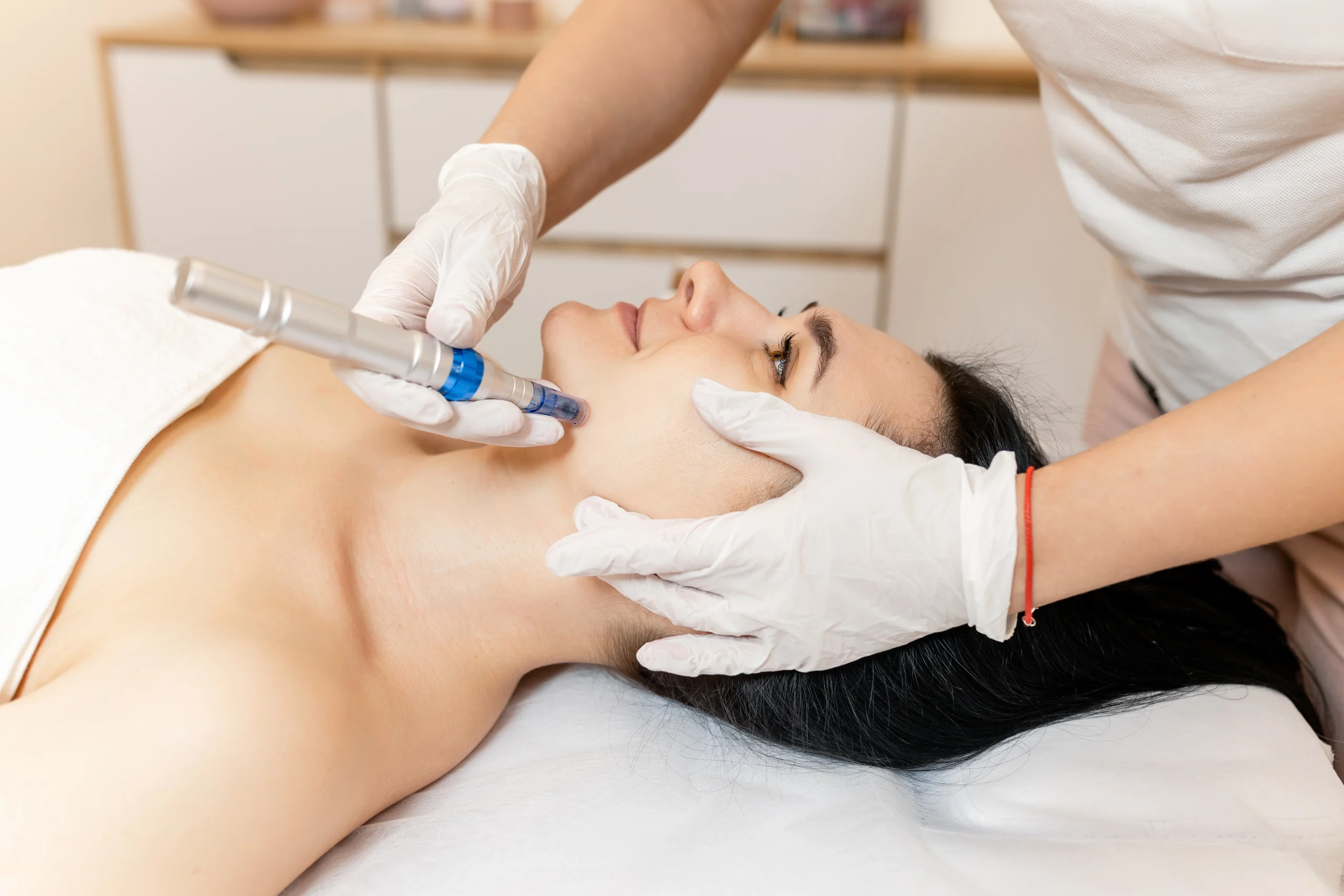 Microneedling in Fort Lee, NJ