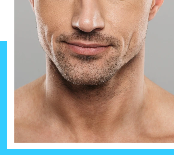 About Chin Liposuction Banner