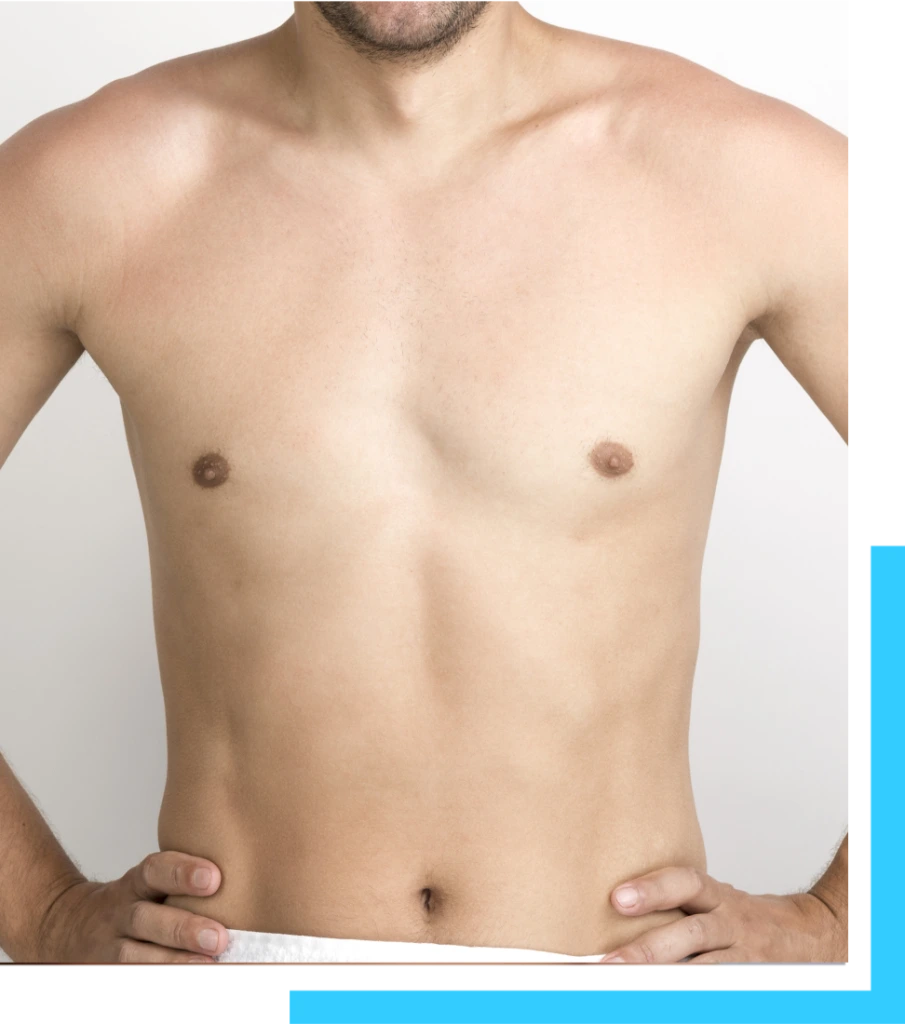 Candidates for Awake Gynecomastia Surgery Banner