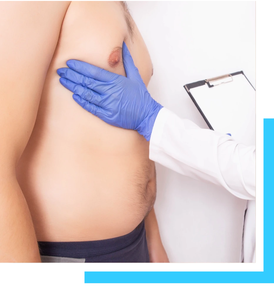 Causes of Gynecomastia Banner