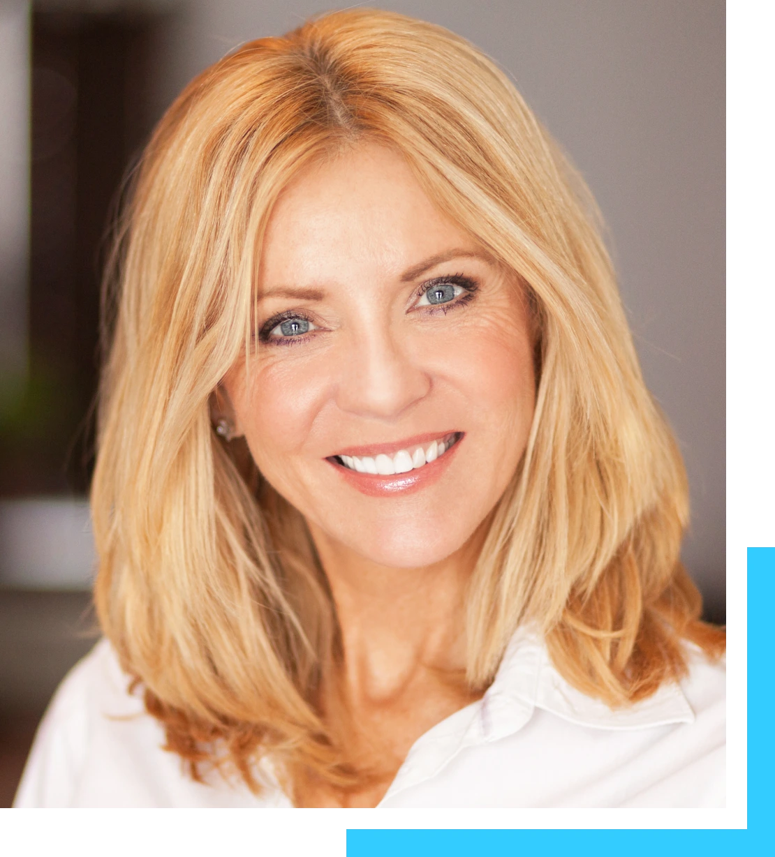 Facelift Procedure Explained Banner