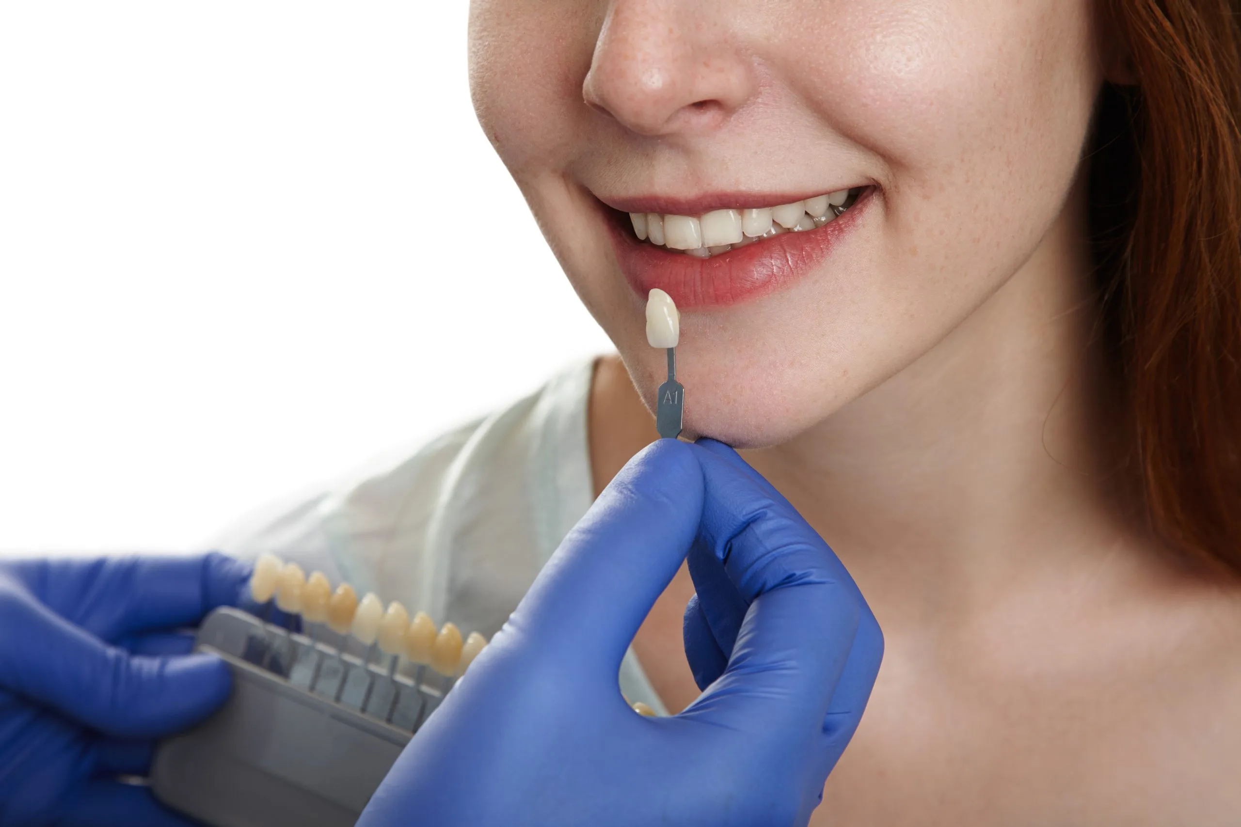 How Long Do Dental Crowns Last? Lifespan and Maintenance