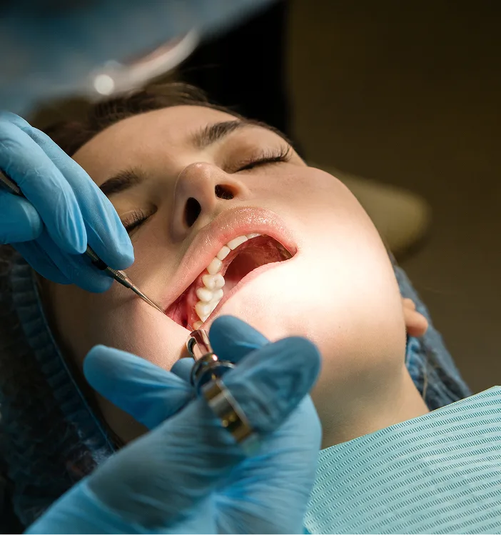 Dentist extracting a tooth from a patient's open mouth using dental forceps