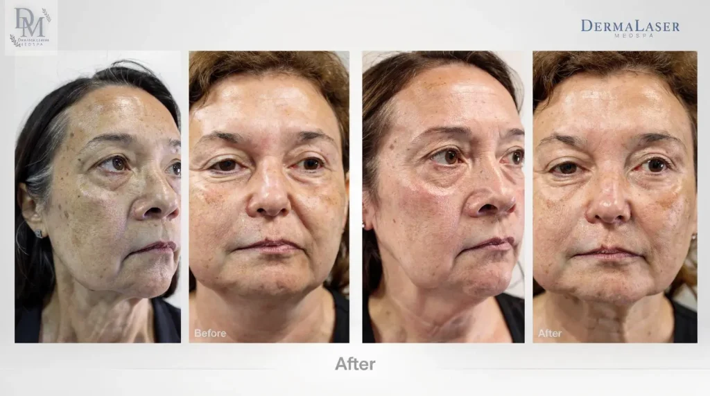 DermaLaser Medspa offers advanced laser and non-invasive aesthetic care in Cumming, GA.; The team provides