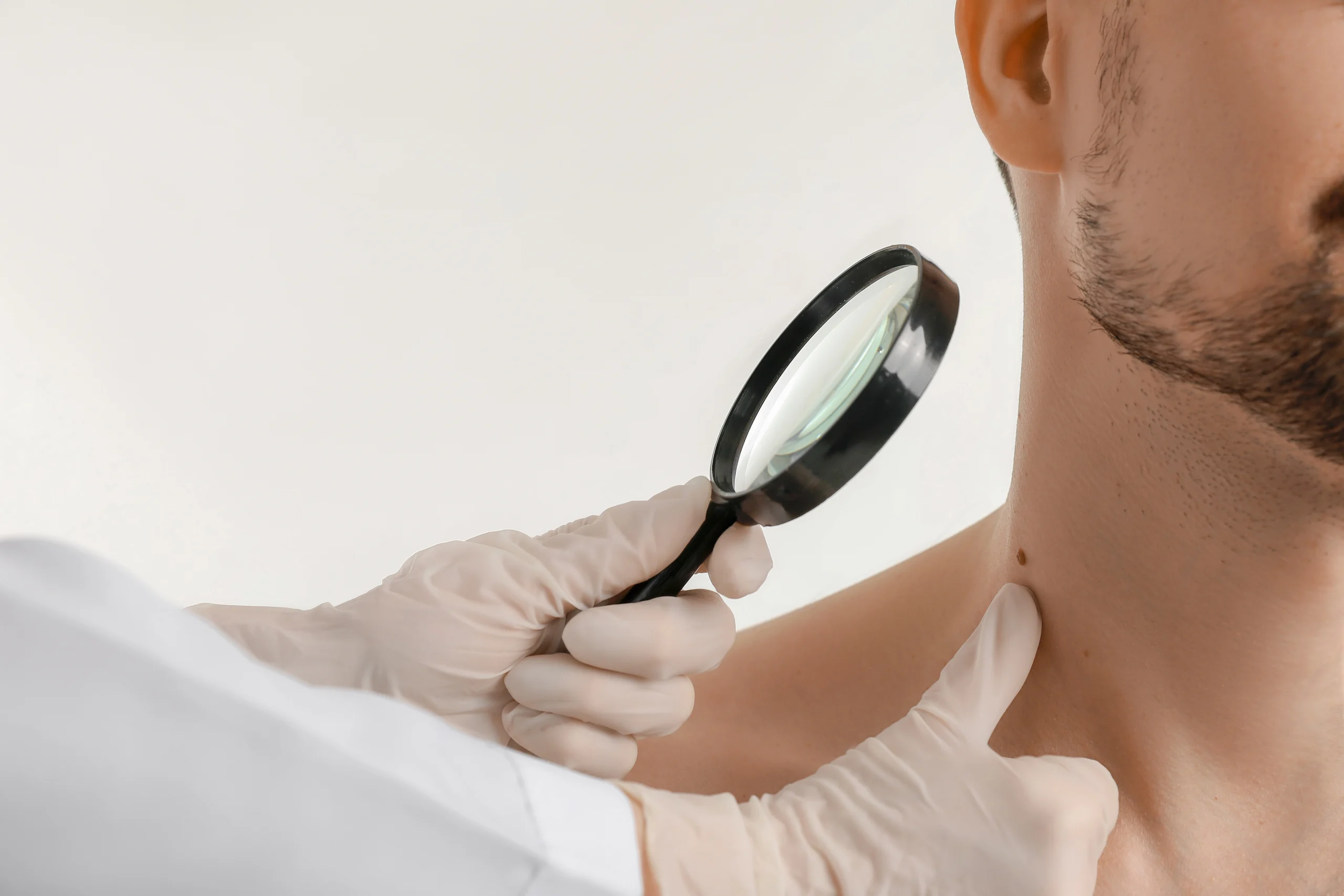 Dermatologist in gloves examining patient's skin with magnifying glass