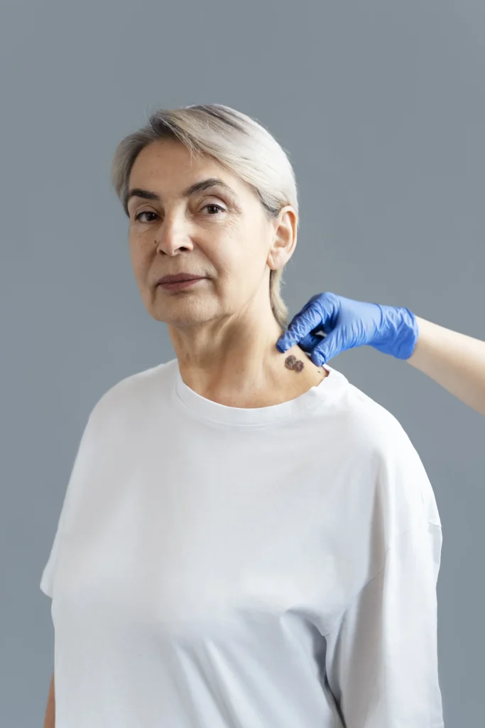 Dermatologist in blue gloves examining a suspicious skin lesion on a patient's neck