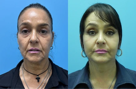 Before and After (2)