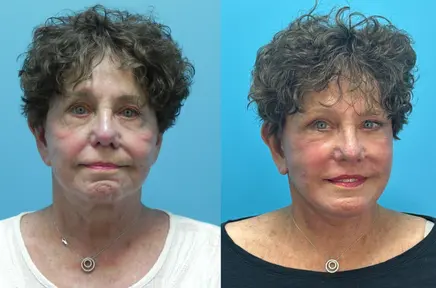 Bafitis - (436 x 288)