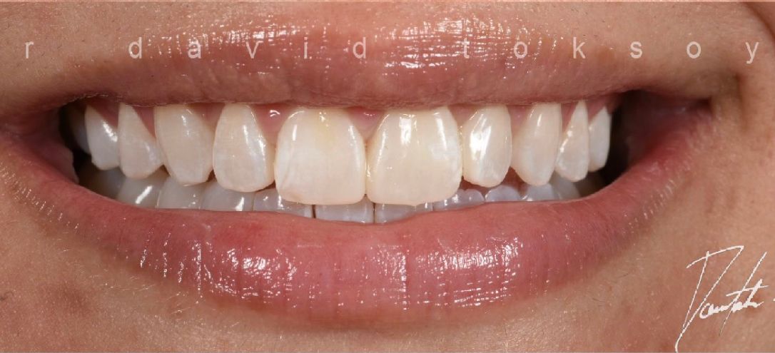 Case 2 After