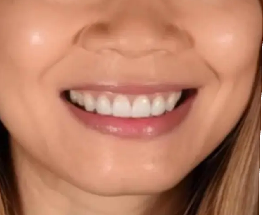 cosmetic-dentistry-images (1)