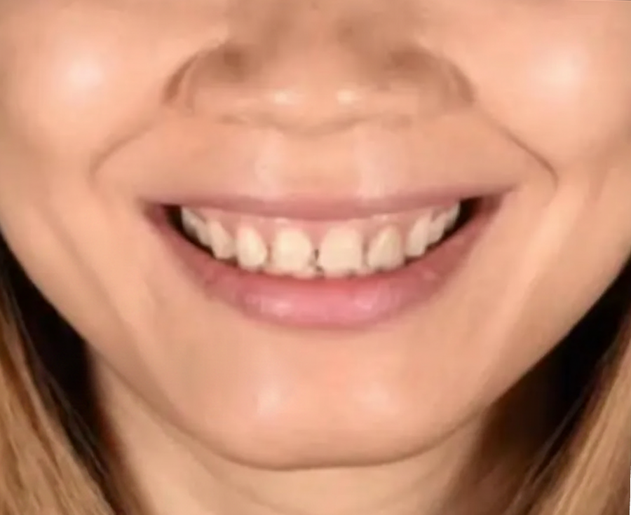 cosmetic-dentistry-images (2)
