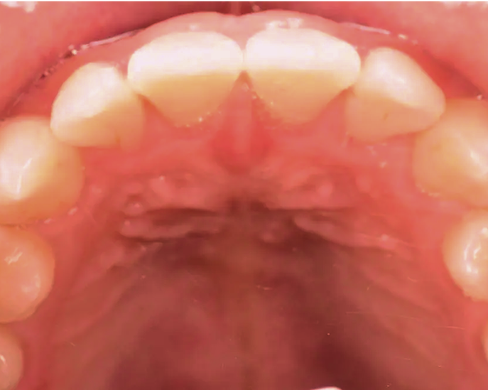 Invisalig-iamges (1)