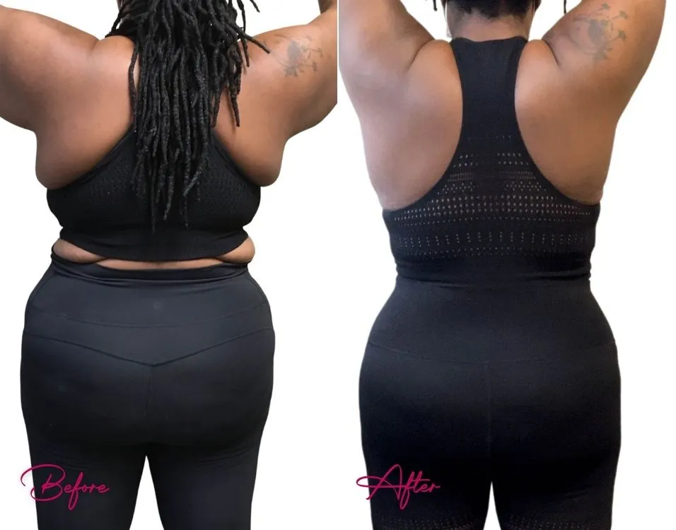 Weight Loss- Case 1