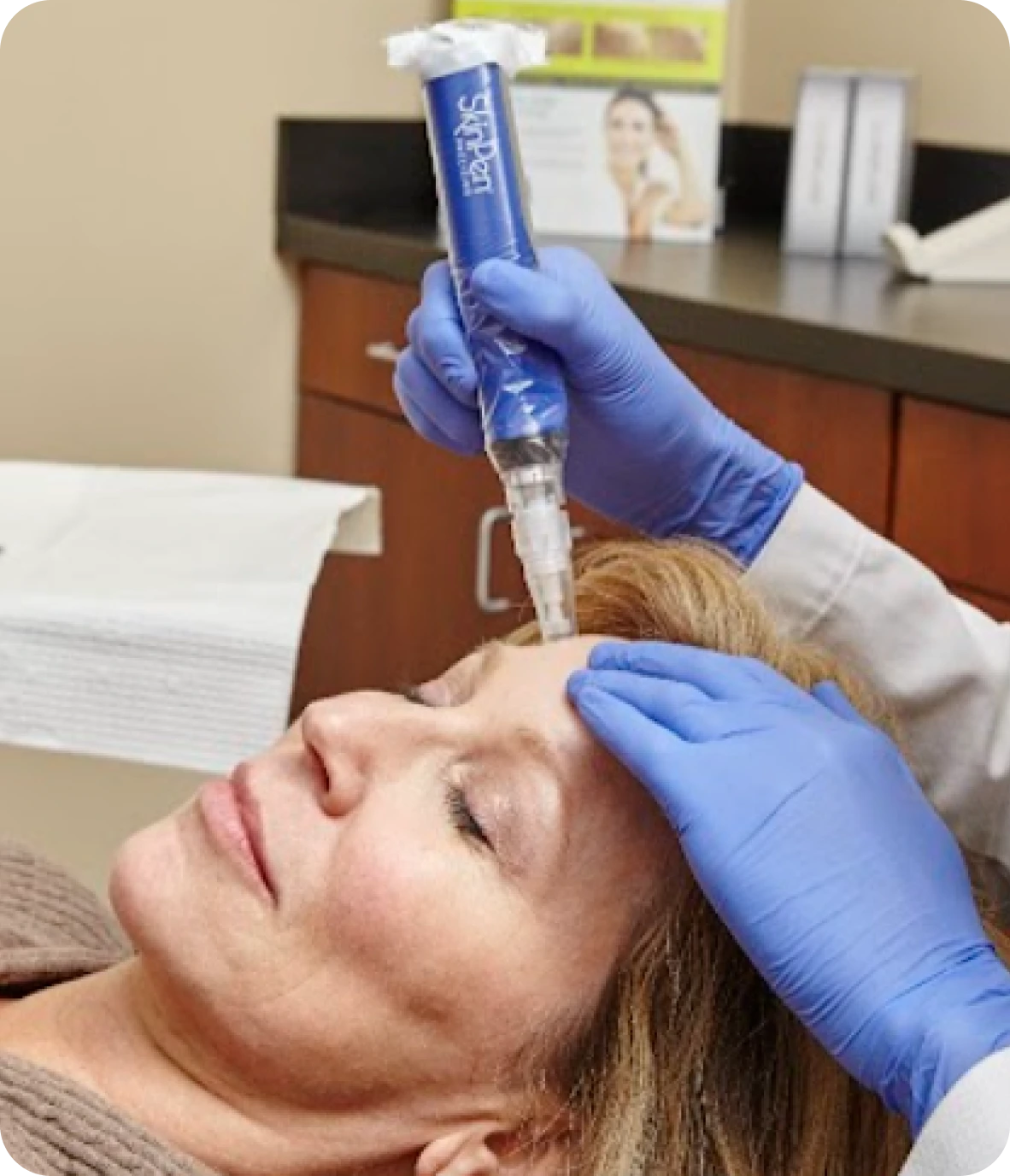 Microneedling with SkinPen Procedure  Banner