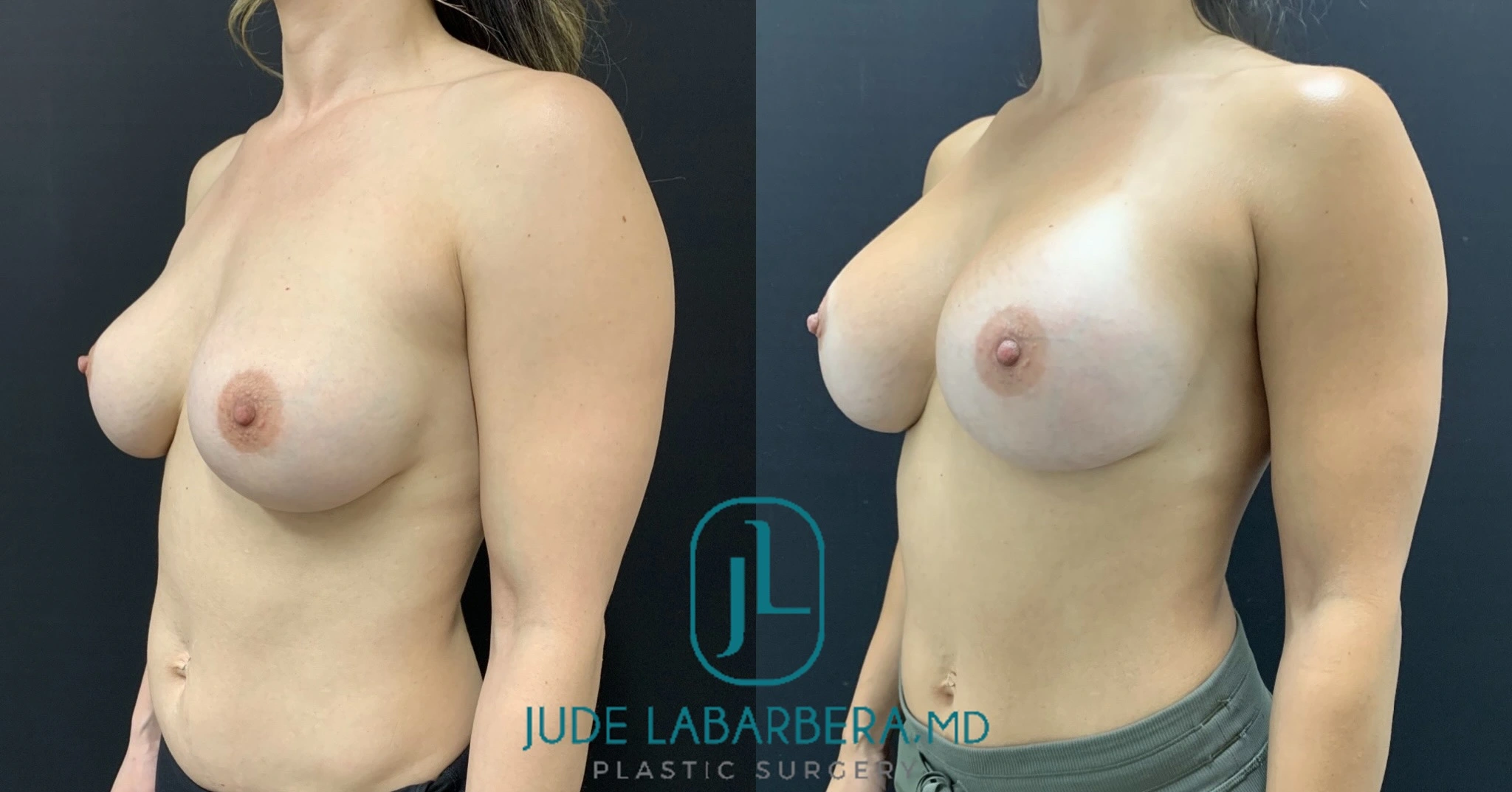 eZy Watermark_25-07-2024_11-09-07-3890AM