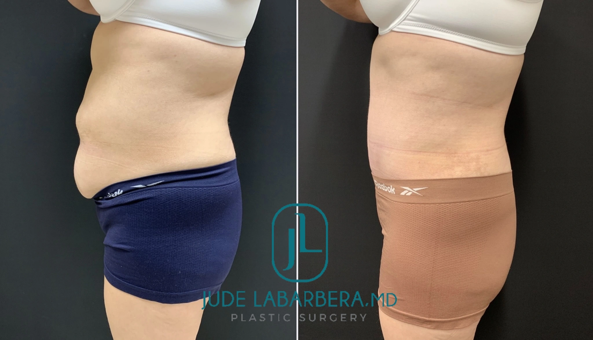 eZy Watermark_11-06-2024_12-56-30-1690PM