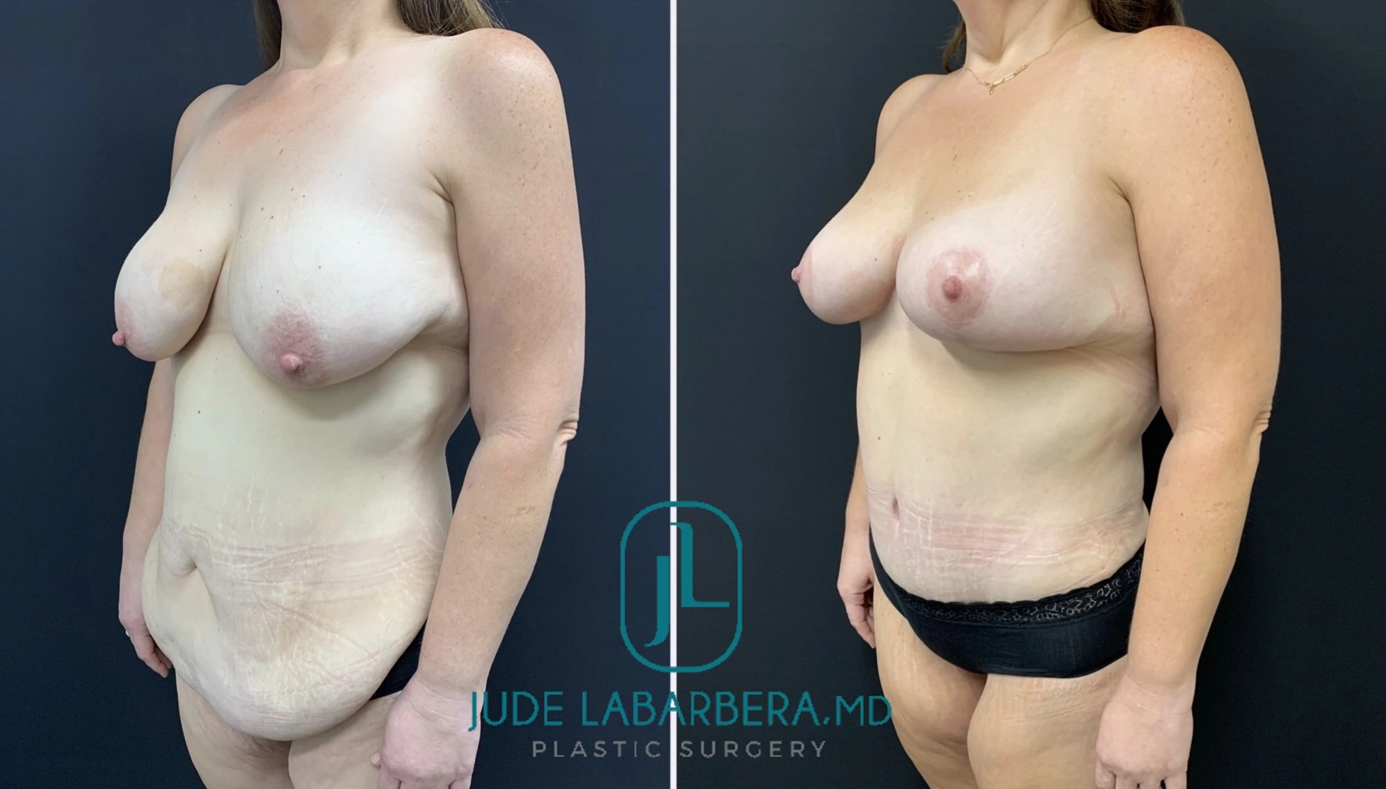 eZy Watermark_01-08-2024_03-46-20-2140PM