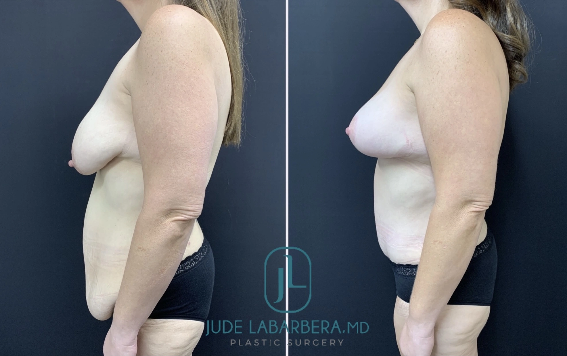 eZy Watermark_01-08-2024_03-46-47-1660PM