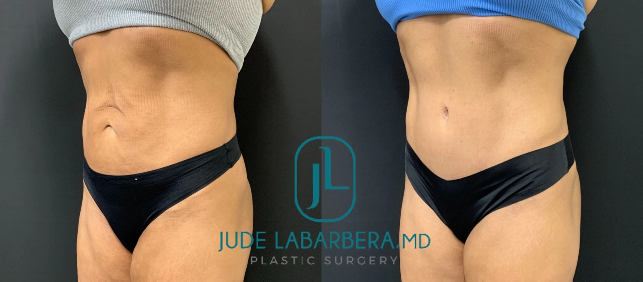 eZy Watermark_07-08-2024_10-31-25-1430AM