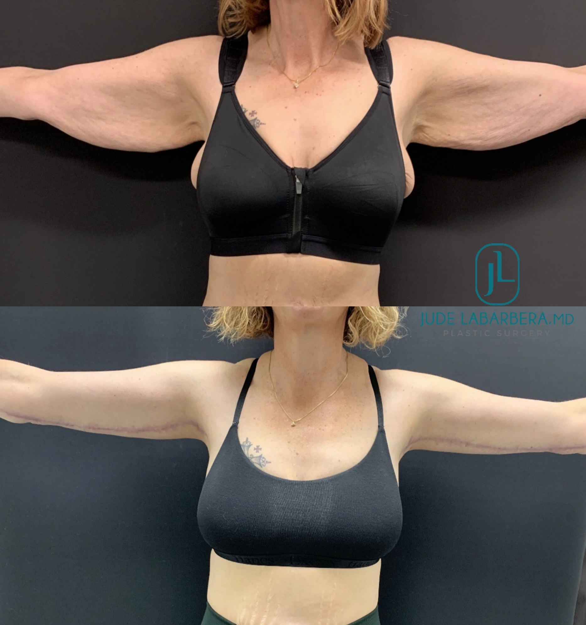 eZy Watermark_08-08-2024_01-27-20-9040PM