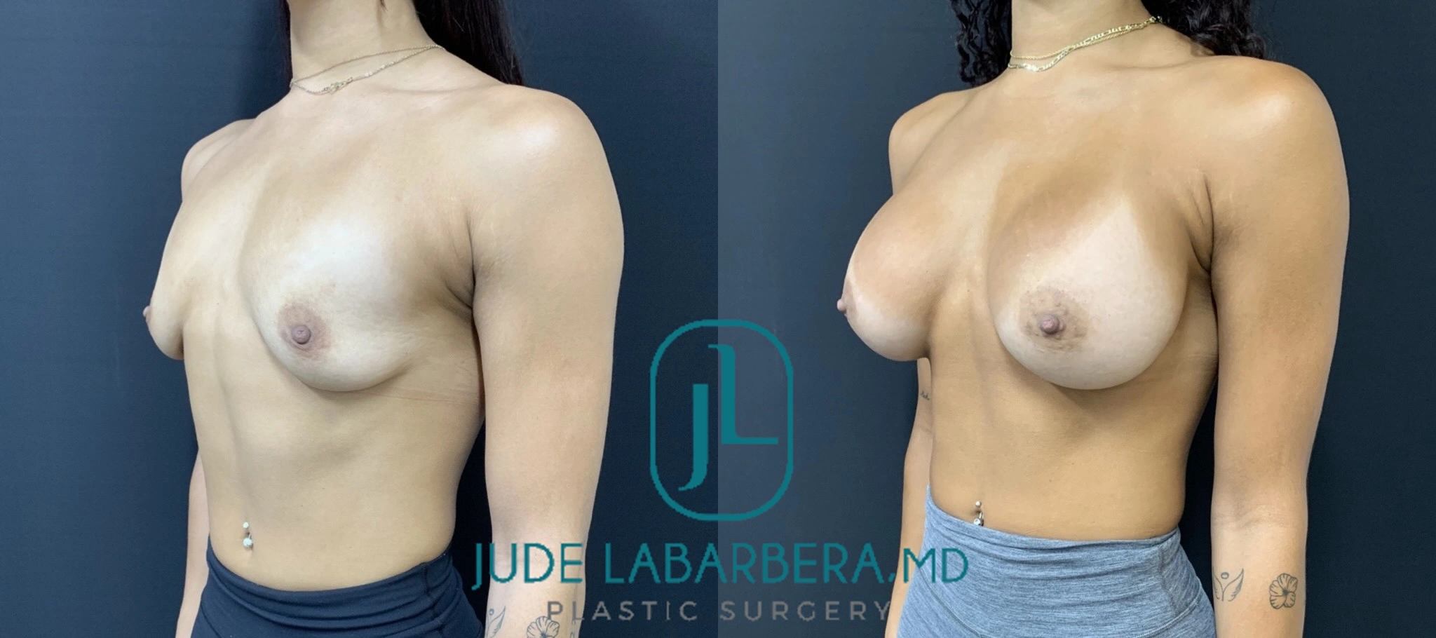 eZy Watermark_16-07-2024_11-56-42-4120AM