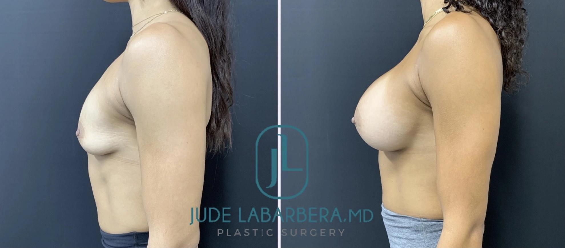 eZy Watermark_16-07-2024_11-56-54-3400AM