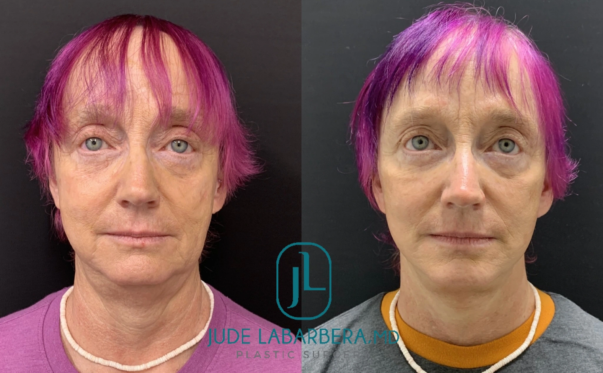 eZy Watermark_31-07-2024_03-39-47-2190PM