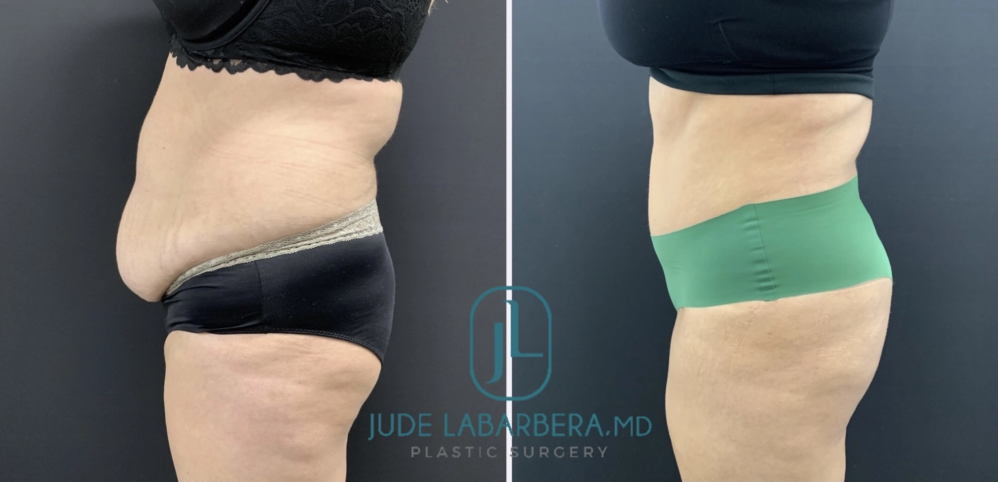 Before & After Banner