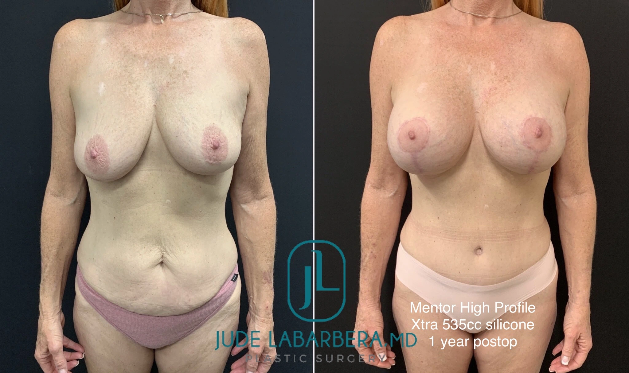 eZy Watermark_11-11-2024_09-40-19-8980AM